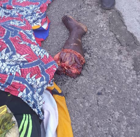 Kindia : une mère et sa fille tuées dans une collision entre une moto et un camion à Mambia